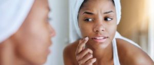 Is Your Skin Barrier Damaged? Here’s How to Tell and How to Fix It.